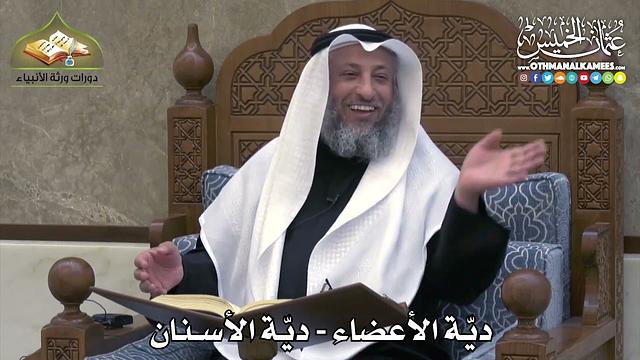 2357 - ديّة الأعضاء - ديّة الأسنان - عثمان الخميس