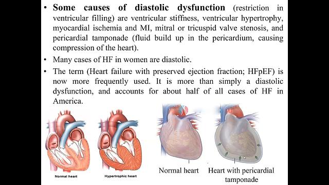 HF 2-Pahthophysiology 2021